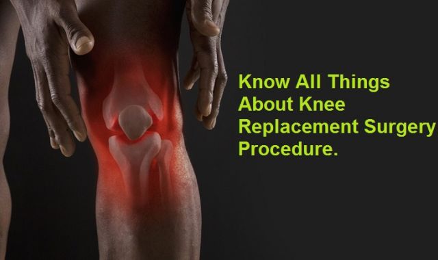 Know all things about Knee Replacement Surgery Procedure.