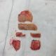 Go to Total Knee Replacement vs Resurfacing