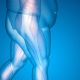 Obesity and Joint Replacement Surgery